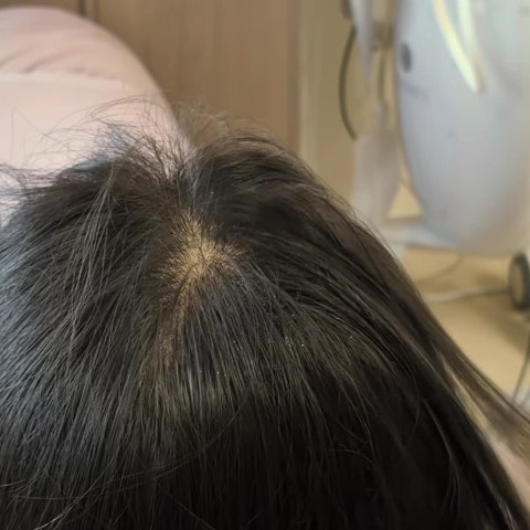 세종 보람동 탈모한의원, 모낭 재생과 두피 순환을 함께 관리합니다 대표 이미지