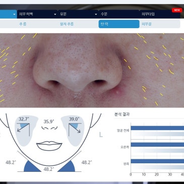보람동리프팅잘하는곳 주름 관리, 매선으로 해야 합니다.