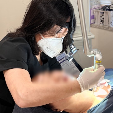 세종편평사마귀후기 무제한으로 제거해주는 곳? (닥터편사 세종점 유일)