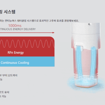 세종볼뉴머리프팅 방법, 효과 등 궁금하다면? 읽어보세요. 대표 이미지